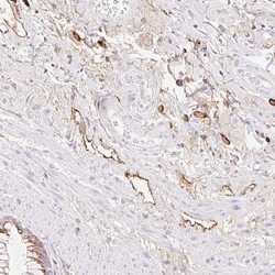 Invitrogen LYVE1 Polyclonal Antibody 100 μL; Unconjugated:Antibodies,