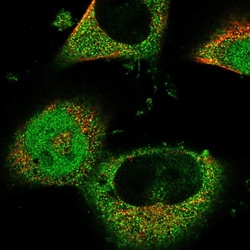 RNF166 Polyclonal Antibody:Antibodies, Polyclonal