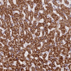 Invitrogen DCI Polyclonal Antibody 100 &mu;L; Unconjugated:Antibodies,