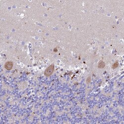 Invitrogen PrP Polyclonal Antibody 100 &mu;L; Unconjugated:Antibodies,