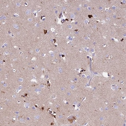 Invitrogen PrP Polyclonal Antibody 100 &mu;L; Unconjugated:Antibodies,