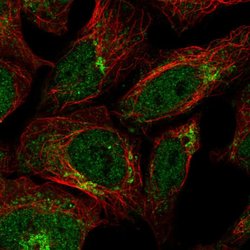 IL17RD Polyclonal Antibody, Invitrogen 100 &mu;L; Unconjugated:Antibodies,