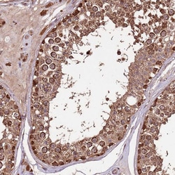 Invitrogen IL17RD Polyclonal Antibody:Antibodies:Primary Antibodies