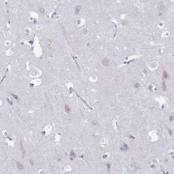 Invitrogen CD35 Polyclonal Antibody 100 μL; Unconjugated:Antibodies,