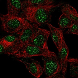 Invitrogen UBD Polyclonal Antibody 100 μL; Unconjugated:Antibodies,