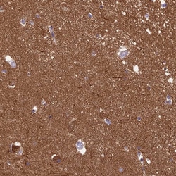 Invitrogen RanBP16 Polyclonal Antibody:Antibodies, Polyclonal