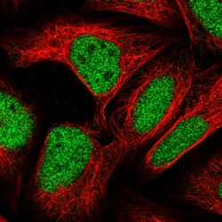 Invitrogen ZBTB22 Polyclonal Antibody 100 μL; Unconjugated:Antibodies,