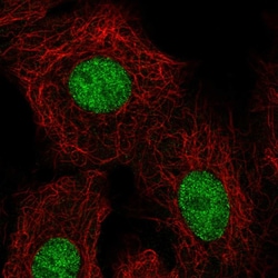 Invitrogen HOXB5 Polyclonal Antibody 100 &mu;L; Unconjugated:Antibodies,