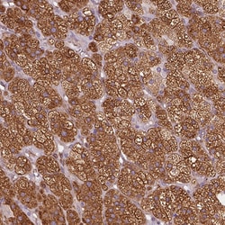 Invitrogen HSD3B1 Polyclonal Antibody 100 &mu;L; Unconjugated:Antibodies,