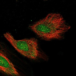 Invitrogen CGBP Polyclonal Antibody 100 &mu;L; Unconjugated:Antibodies,