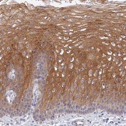 Invitrogen HOXB1 Polyclonal Antibody 100 &mu;L; Unconjugated:Antibodies,