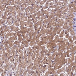 Invitrogen AHCY Polyclonal Antibody 100 &mu;L; Unconjugated:Antikörper