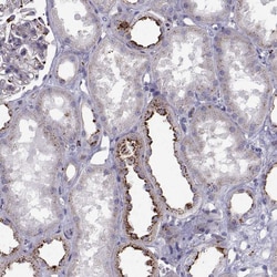 Invitrogen CLN2 Polyclonal Antibody 100 &mu;L; Unconjugated:Antibodies,