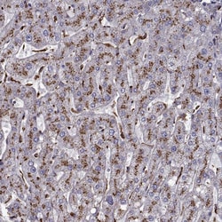 Invitrogen CLN2 Polyclonal Antibody 100 &mu;L; Unconjugated:Antibodies,