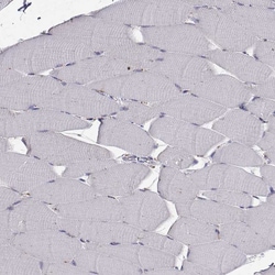 Invitrogen CLN2 Polyclonal Antibody 100 &mu;L; Unconjugated:Antibodies,