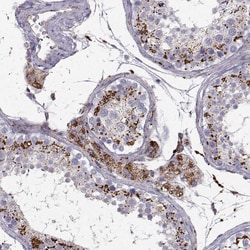Invitrogen CLN2 Polyclonal Antibody 100 &mu;L; Unconjugated:Antibodies,