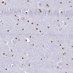 Invitrogen RYK Polyclonal Antibody 100 &mu;L; Unconjugated:Antibodies,