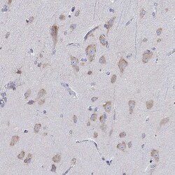Invitrogen Lass1 Polyclonal Antibody 100 &mu;L; Unconjugated:Antibodies,