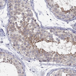 Invitrogen Lass1 Polyclonal Antibody 100 &mu;L; Unconjugated:Antibodies,