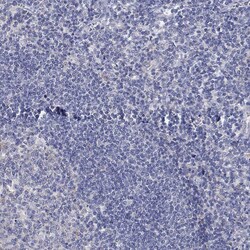 Invitrogen Lass1 Polyclonal Antibody 100 &mu;L; Unconjugated:Antibodies,