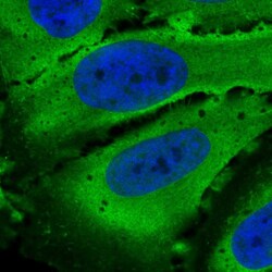 Invitrogen PDE4D Polyclonal Antibody 100 μL; Unconjugated:Antibodies,