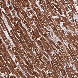 Invitrogen PDE4D Polyclonal Antibody 100 μL; Unconjugated:Antibodies,