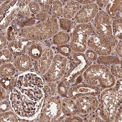 Invitrogen PDE4D Polyclonal Antibody 100 μL; Unconjugated:Antibodies,