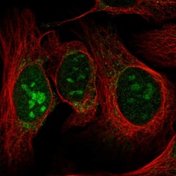RPL7L1 Polyclonal Antibody:Antibodies, Polyclonal