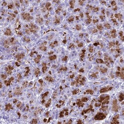 Invitrogen Bestrophin 2 Polyclonal Antibody 100 μL; Unconjugated:Antibodies,