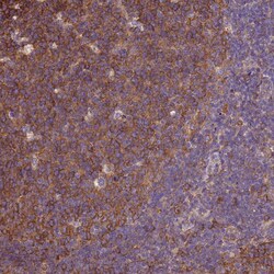 Invitrogen beta Tubulin Polyclonal Antibody 100 &mu;L; Unconjugated:Antibodies,
