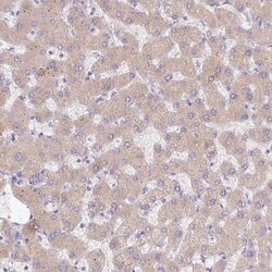 Invitrogen Complement C4a Polyclonal Antibody 100 &mu;L; Unconjugated:Antibodies,