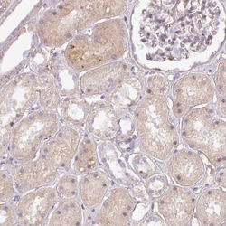 Invitrogen Complement C4a Polyclonal Antibody:Anticuerpos:Anticuerpos primarios