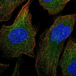 Invitrogen MEKK1 Polyclonal Antibody 100 μL; Unconjugated:Antibodies,