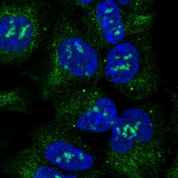 Invitrogen ACVR1 Polyclonal Antibody 100 &mu;L; Unconjugated:Antibodies,