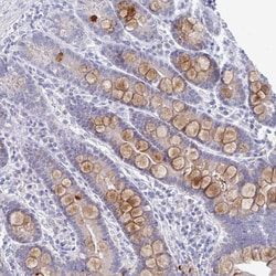 Invitrogen EBI3 Polyclonal Antibody 100 &mu;L; Unconjugated:Antibodies,