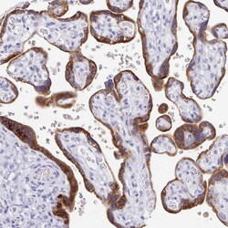 Invitrogen EBI3 Polyclonal Antibody 100 &mu;L; Unconjugated:Antibodies,