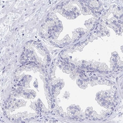 Invitrogen EBI3 Polyclonal Antibody 100 &mu;L; Unconjugated:Antibodies,