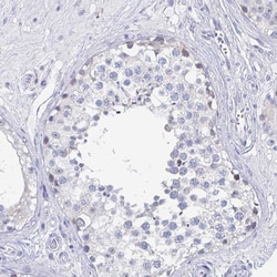 Invitrogen EBI3 Polyclonal Antibody 100 &mu;L; Unconjugated:Antibodies,