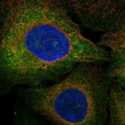 Invitrogen FLT3 Polyclonal Antibody 100 &mu;L; Unconjugated:Antibodies,
