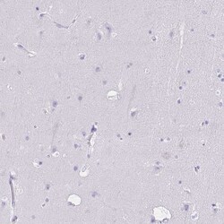 Invitrogen p47phox Polyclonal Antibody 100 &mu;L | Buy Online | Invitrogen&trade; | Fisher Scientific