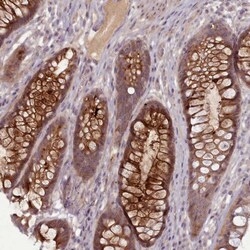 Invitrogen LEFTY Polyclonal Antibody 100 &mu;L; Unconjugated:Antibodies,