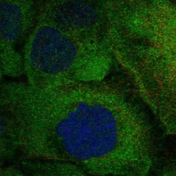 Invitrogen RANK Polyclonal Antibody 100 &mu;L; Unconjugated:Antibodies,