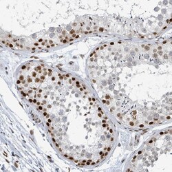 Invitrogen SUMO2 Polyclonal Antibody 100 &mu;L; Unconjugated:Antibodies,