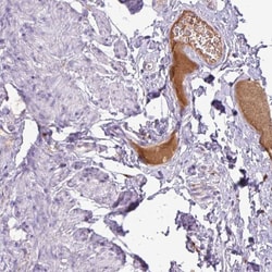 Invitrogen Complement C4a Polyclonal Antibody:Antibodies:Primary Antibodies