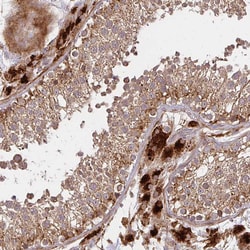 Invitrogen GNS Polyclonal Antibody 100 &mu;L; Unconjugated:Antibodies,