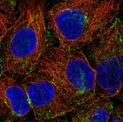 Invitrogen PHLPP2 Polyclonal Antibody 100 &mu;L; Unconjugated:Antibodies,