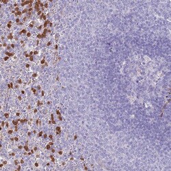 Invitrogen PHLPP2 Polyclonal Antibody 100 &mu;L; Unconjugated:Antibodies,