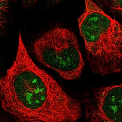 Invitrogen Apoptosis-Enhancing Nuclease Polyclonal Antibody 100 &mu;L;