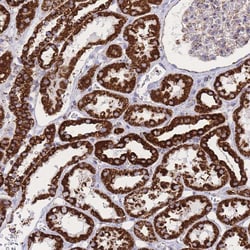 Invitrogen GSTM1 Polyclonal Antibody 100 μL; Unconjugated:Antibodies,