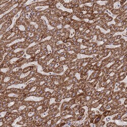 Invitrogen GSTM1 Polyclonal Antibody 100 μL; Unconjugated:Antibodies,